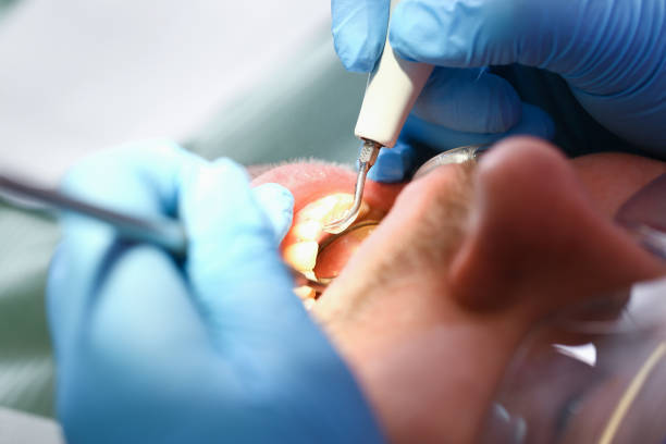 Best Dentist for Tooth Abscess  in Westwood, NJ