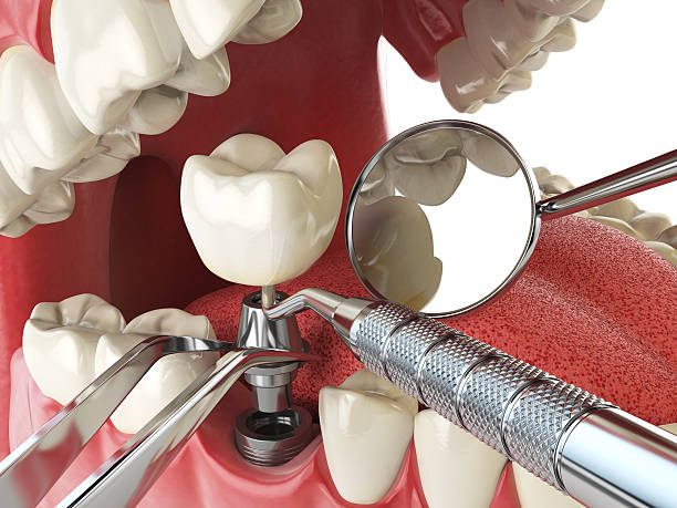 Best Cracked Tooth Emergency Dentist  in Westwood, NJ