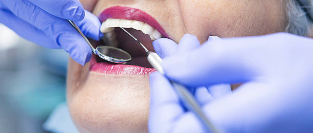 Best Chipped Tooth Repair Near Me  in Westwood, NJ